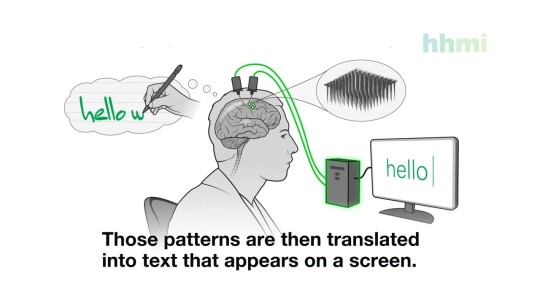 Los electrodos implantados en la corteza motora del hombre registraron señales de su actividad cerebral