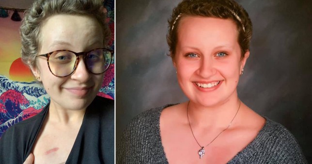 Una estudiante de secundaria se rompió el corazón cuando descubrió que la cicatriz de su puerto de quimioterapia había sido cortada de las fotos de su anuario.